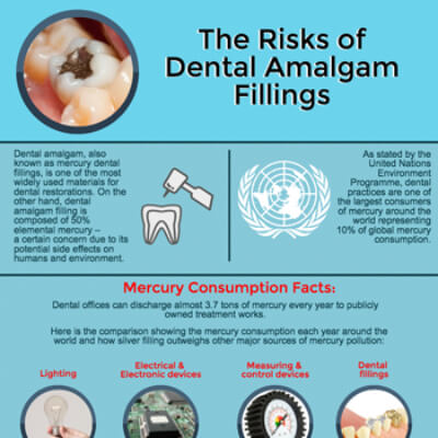 The Risks of Dental Amalgam Fillings