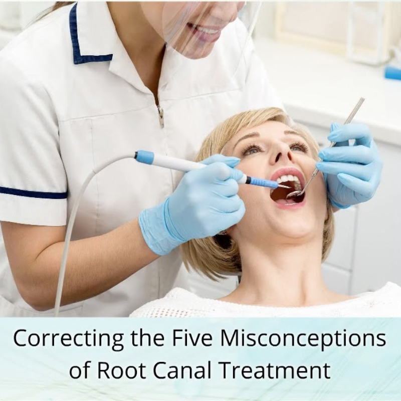 Correcting the Five Misconceptions of Root Canal Treatment