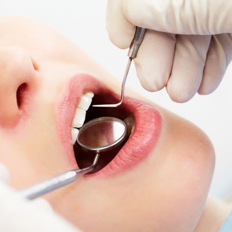 The Wonders of Professional Teeth Cleaning for Oral Health