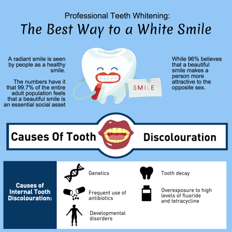 Professional Teeth Whitening: The Best Way to a White Smile