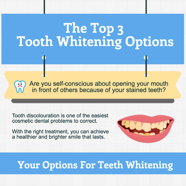 The Top 3 Tooth Whitening Options
