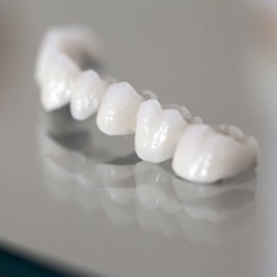 Types of Dental Bridges and How to Care For It